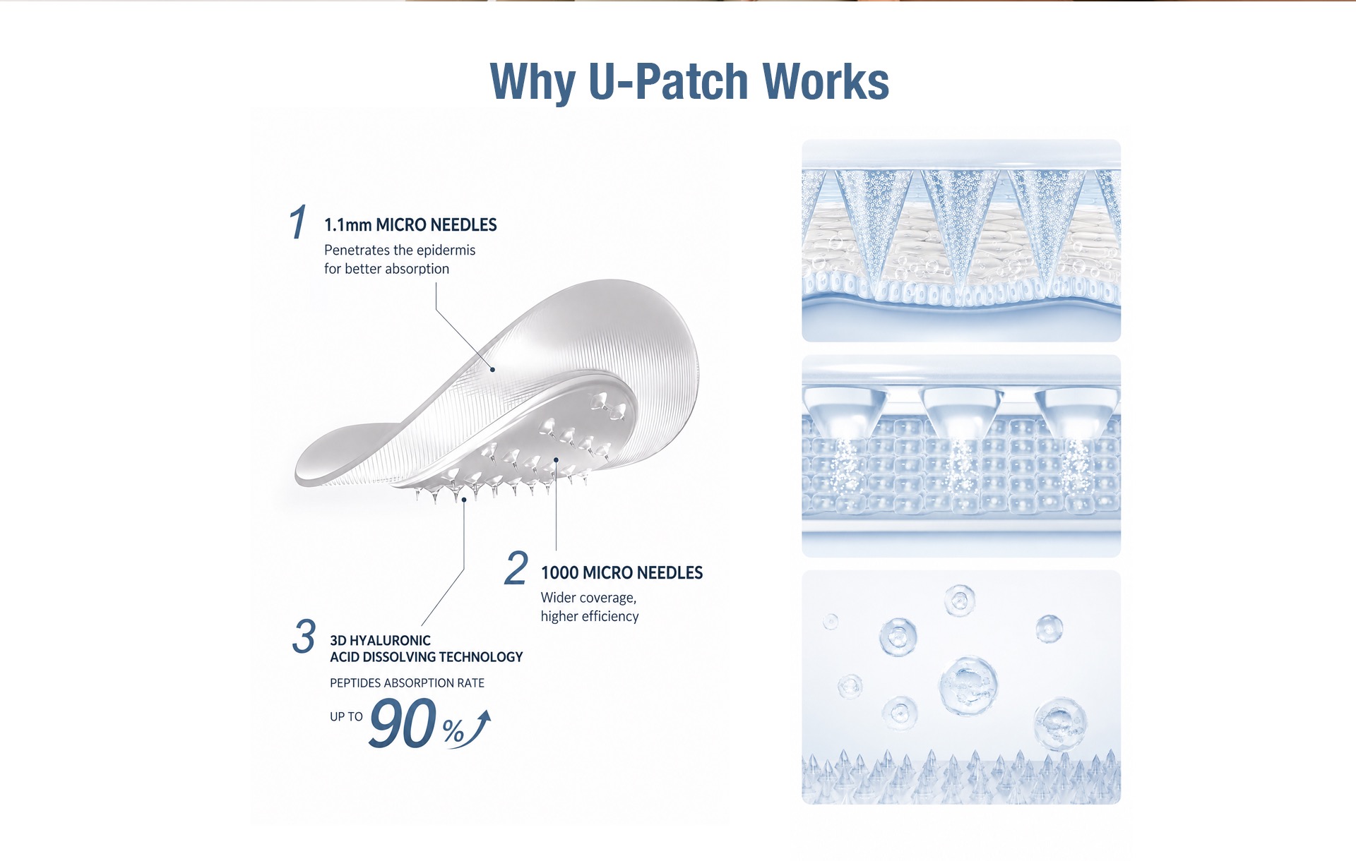 Why U-Patch Works technology diagram from the reference design